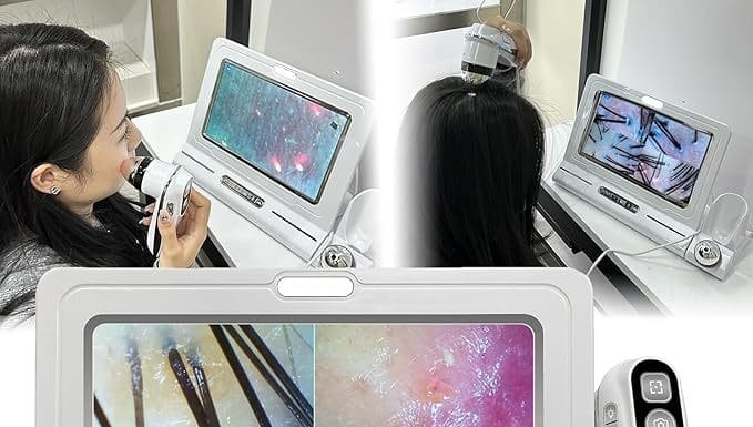 Skin & Scalp Analyzer Review: Is This 11-Inch HD Device Worth the Investment for Salons?