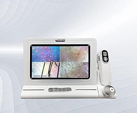 Skin Hair Scalp Detector Review: Is This 11-Inch HD Microscope Worth the Investment?